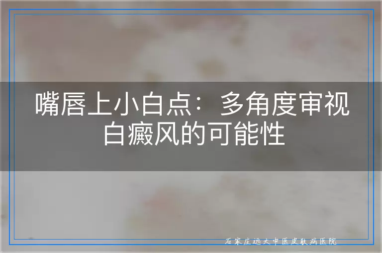 嘴唇上小白点：多角度审视白癜风的可能性