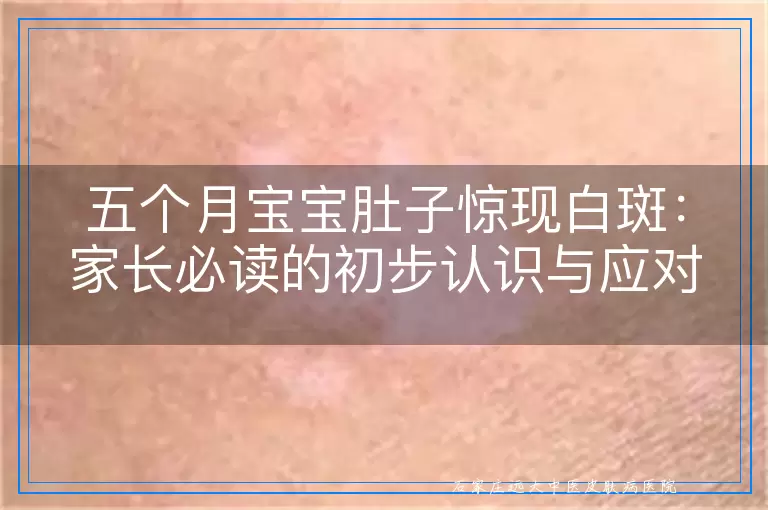 五个月宝宝肚子惊现白斑：家长必读的初步认识与应对指南