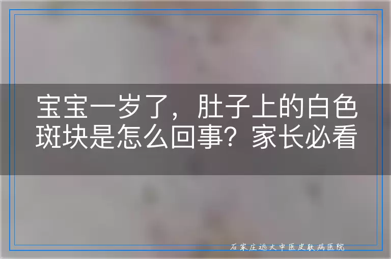 宝宝一岁了，肚子上的白色斑块是怎么回事？家长必看的白斑知识科普
