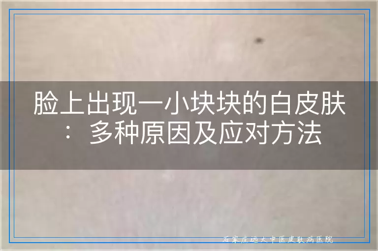 脸上出现一小块块的白皮肤：多种原因及应对方法