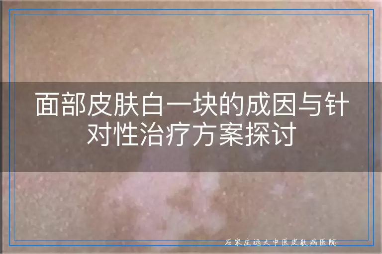 面部皮肤白一块的成因与针对性治疗方案探讨