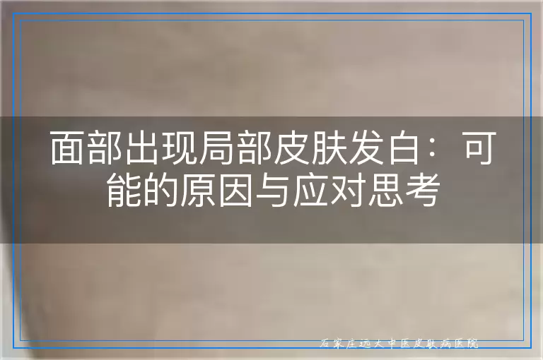 面部出现局部皮肤发白：可能的原因与应对思考