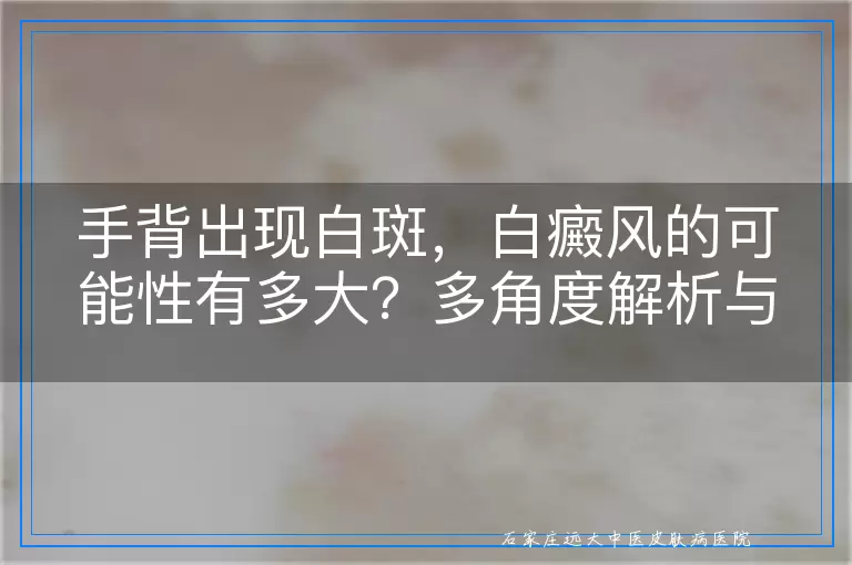手背出现白斑，白癜风的可能性有多大？多角度解析与识别