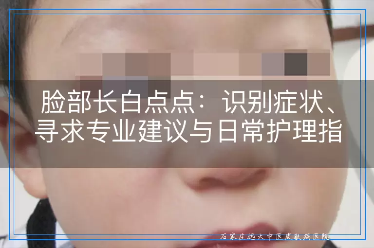 脸部长白点点：识别症状、寻求专业建议与日常护理指南