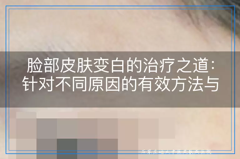脸部皮肤变白的治疗之道：针对不同原因的有效方法与建议