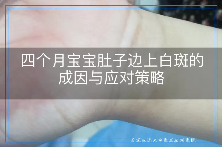 四个月宝宝肚子边上白斑的成因与应对策略