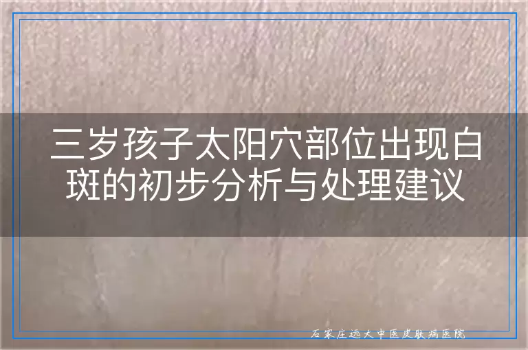 三岁孩子太阳穴部位出现白斑的初步分析与处理建议