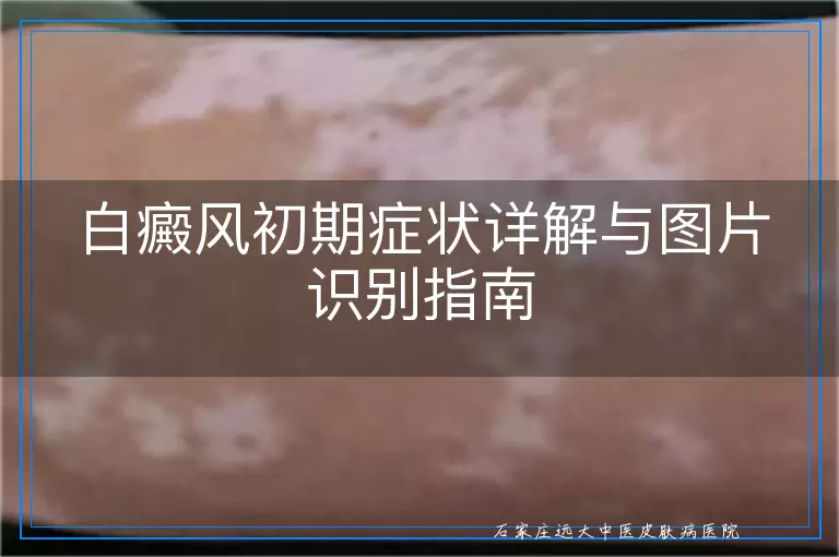 白癜风初期症状详解与图片识别指南