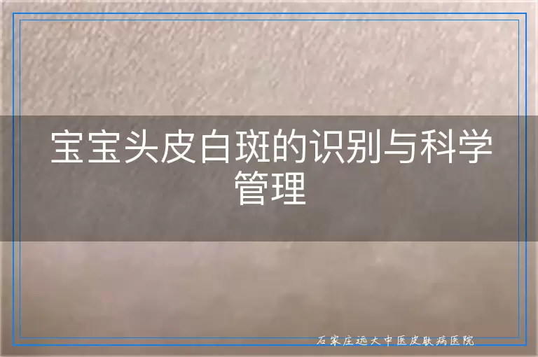 宝宝头皮白斑的识别与科学管理