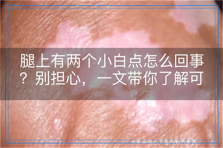 腿上有两个小白点怎么回事？别担心，一文带你了解可能的原因！