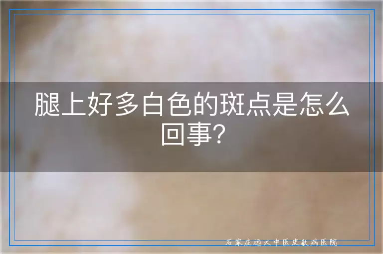腿上好多白色的斑点是怎么回事？