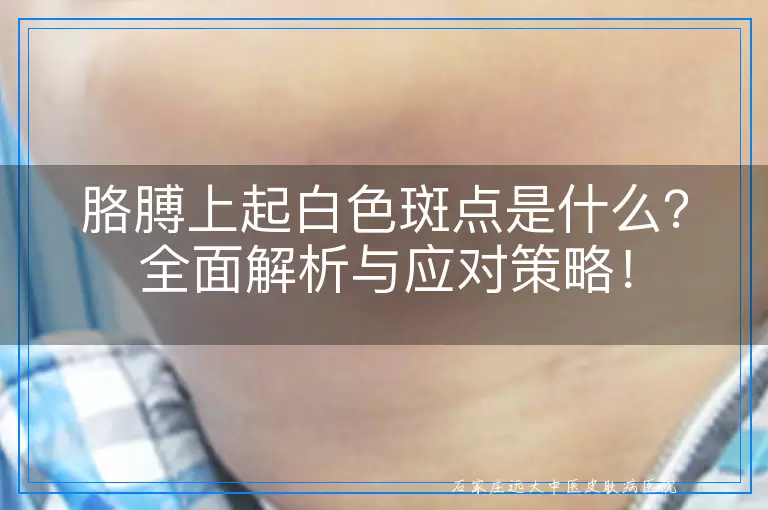 胳膊上起白色斑点是什么？全面解析与应对策略！