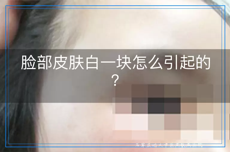 脸部皮肤白一块怎么引起的？