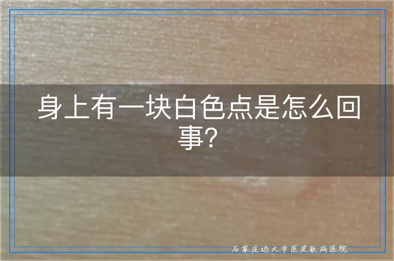 身上有一块白色点是怎么回事？