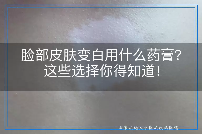 脸部皮肤变白用什么药膏？这些选择你得知道！