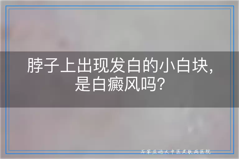 脖子上出现发白的小白块，是白癜风吗？