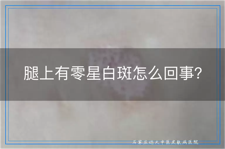 腿上有零星白斑怎么回事？