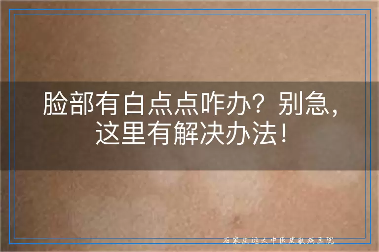 脸部有白点点咋办？别急，这里有解决办法！