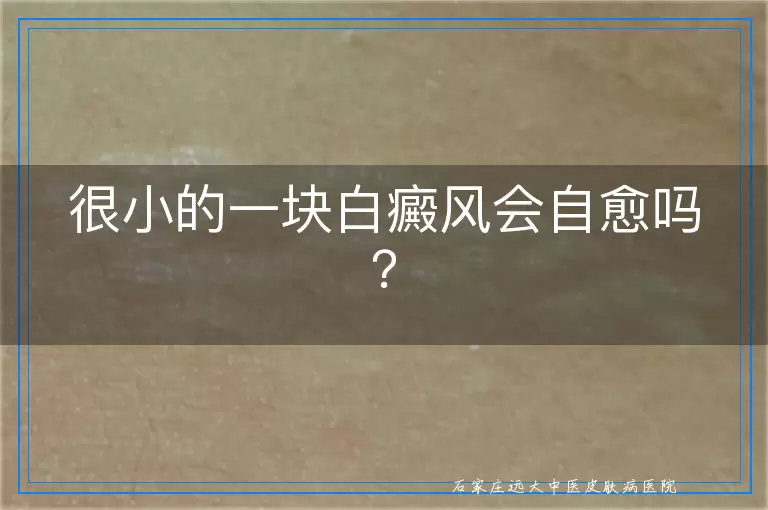 很小的一块白癜风会自愈吗？