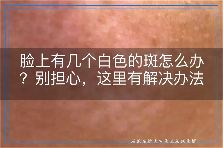 脸上有几个白色的斑怎么办？别担心，这里有解决办法！