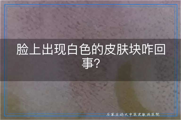 脸上出现白色的皮肤块咋回事？