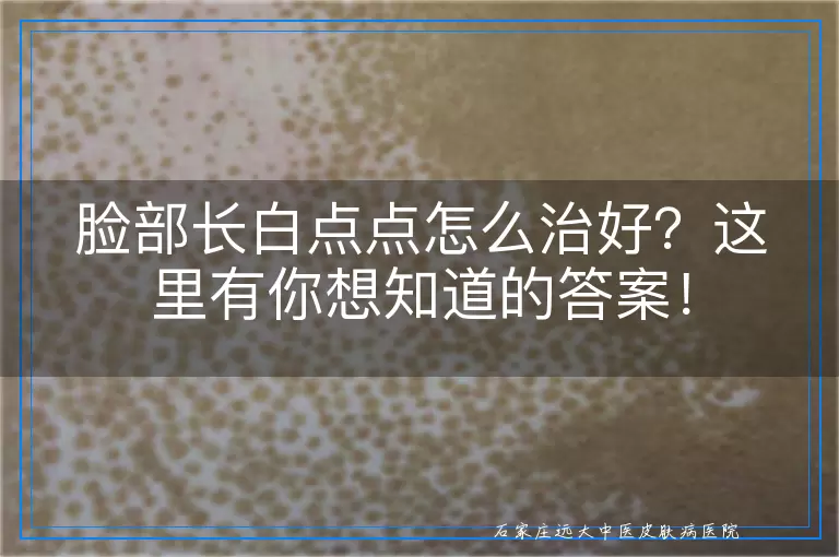 脸部长白点点怎么治好？这里有你想知道的答案！