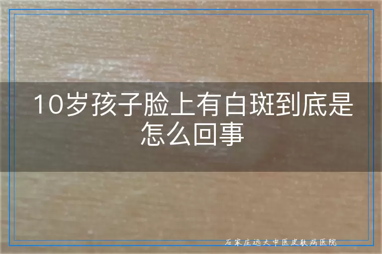 10岁孩子脸上有白斑到底是怎么回事