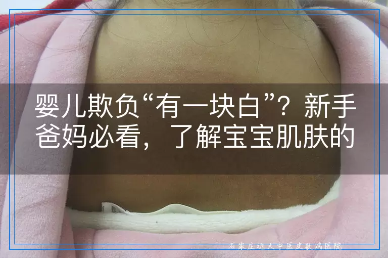 婴儿欺负“有一块白”？新手爸妈必看，了解宝宝肌肤的小秘密！