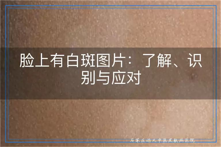 脸上有白斑图片：了解、识别与应对