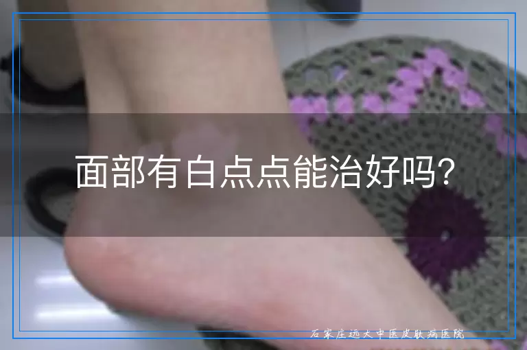 面部有白点点能治好吗？