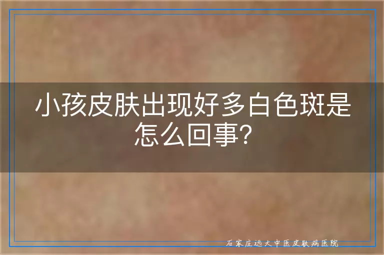 小孩皮肤出现好多白色斑是怎么回事？