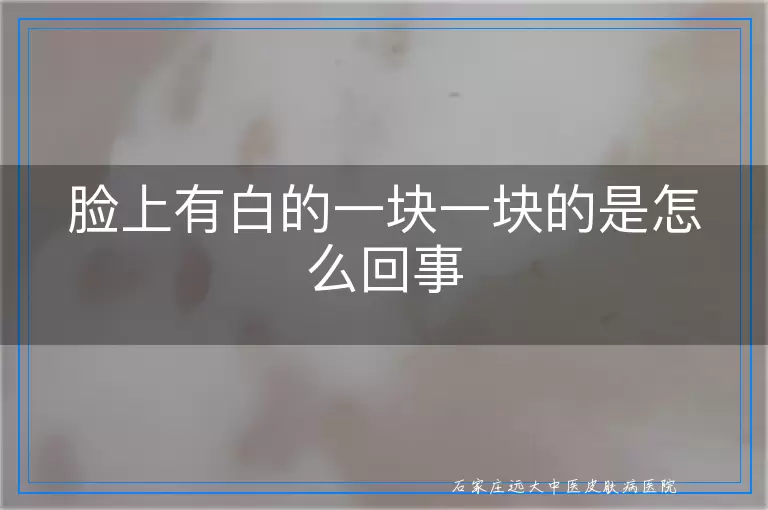 脸上有白的一块一块的是怎么回事