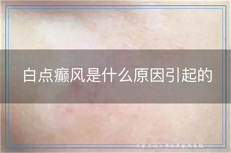 白点癫风是什么原因引起的