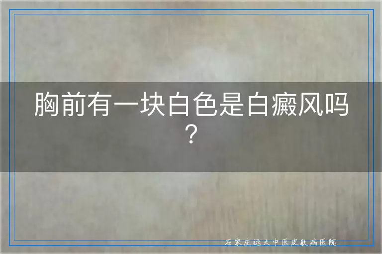 胸前有一块白色是白癜风吗？