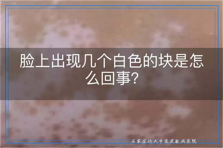 脸上出现几个白色的块是怎么回事？