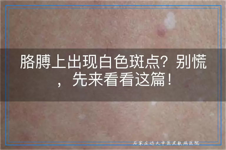 胳膊上出现白色斑点？别慌，先来看看这篇！