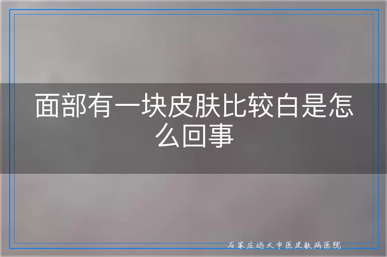 面部有一块皮肤比较白是怎么回事