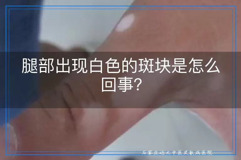 腿部出现白色的斑块是怎么回事？
