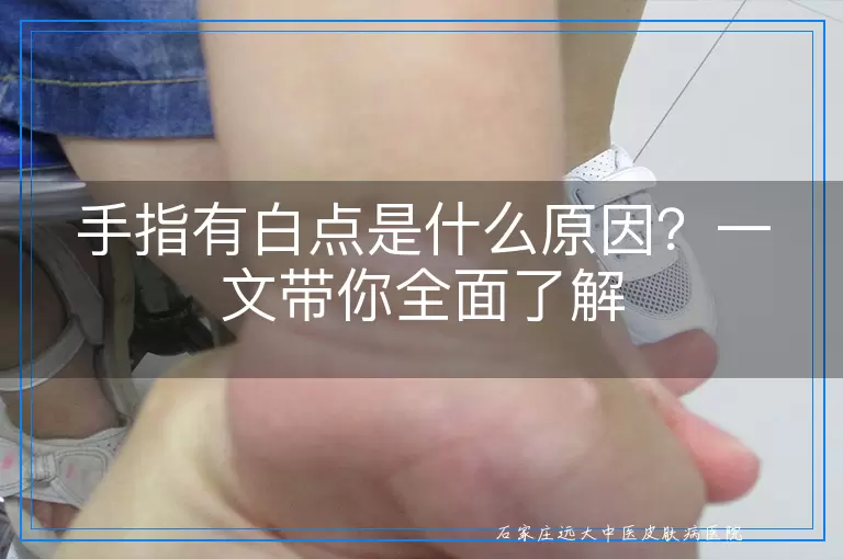 手指有白点是什么原因？一文带你全面了解