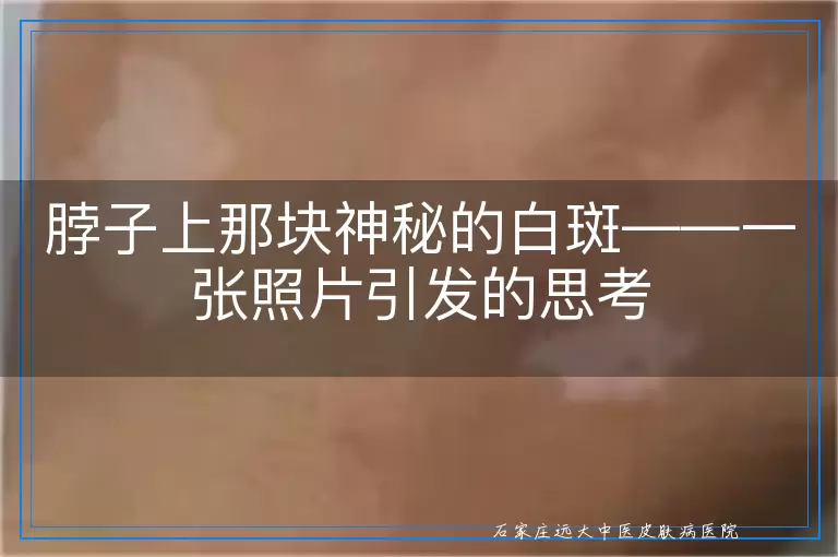 脖子上那块神秘的白斑——一张照片引发的思考