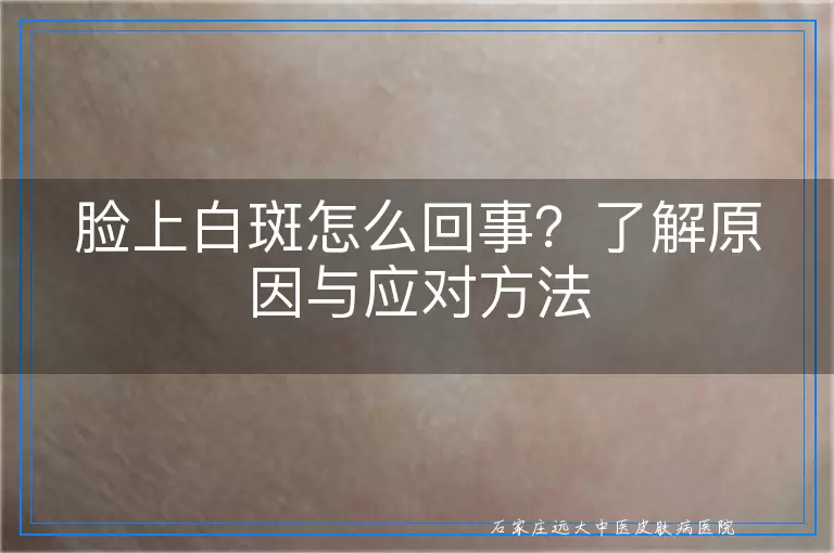脸上白斑怎么回事？了解原因与应对方法