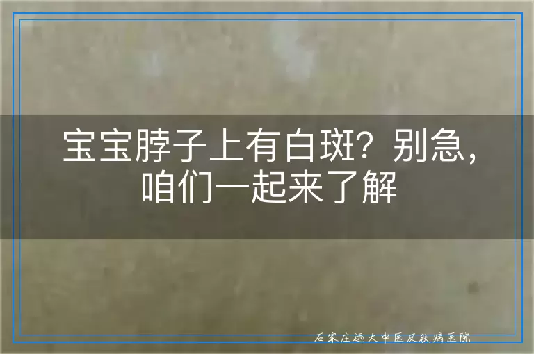 宝宝脖子上有白斑？别急，咱们一起来了解