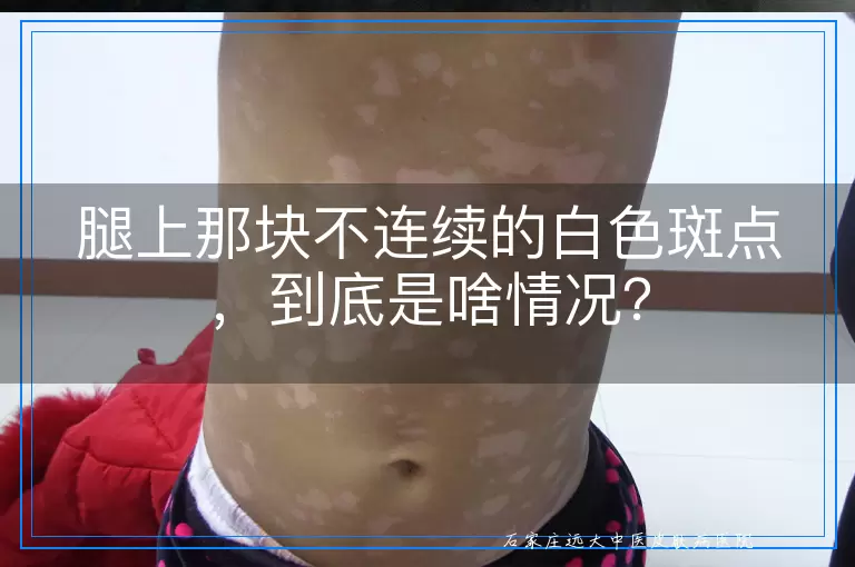 腿上那块不连续的白色斑点，到底是啥情况？