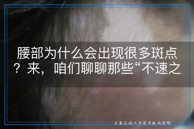 腰部为什么会出现很多斑点？来，咱们聊聊那些“不速之客”