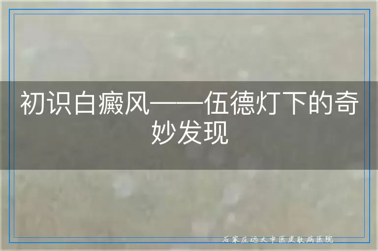 初识白癜风——伍德灯下的奇妙发现