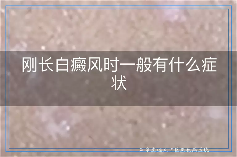 刚长白癜风时一般有什么症状