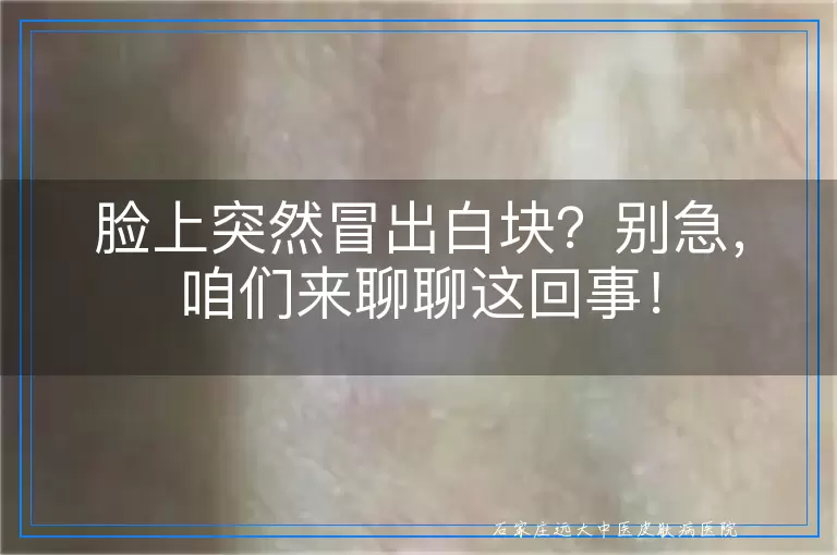 脸上突然冒出白块？别急，咱们来聊聊这回事！