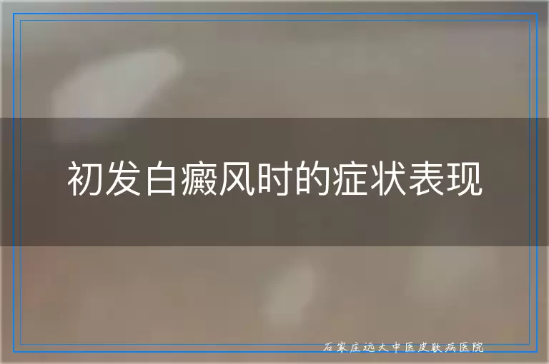 初发白癜风时的症状表现
