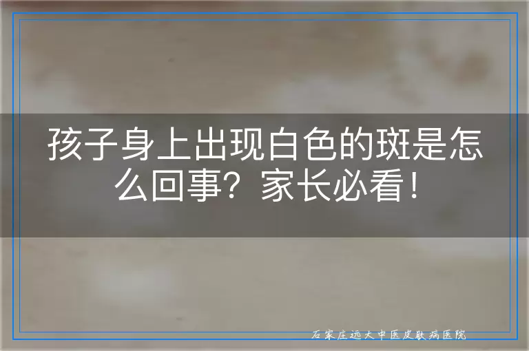 孩子身上出现白色的斑是怎么回事？家长必看！