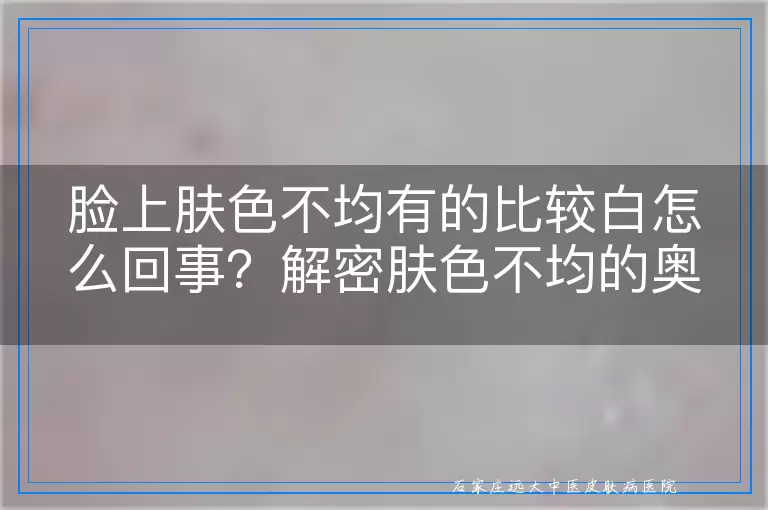 脸上肤色不均有的比较白怎么回事？解密肤色不均的奥秘！